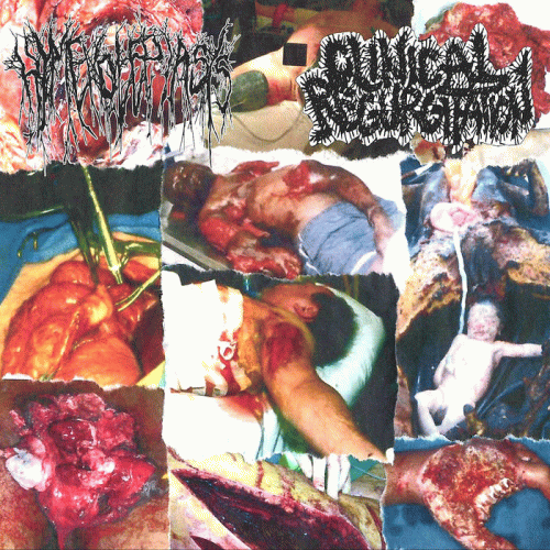 Clinical Regurgitation : Clinical Regurgitation - Hymenolepiasis Clinical Regurgitation : Clinical Regurgitation - Hymenolepiasis